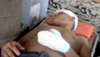 الأمم المتحدة تدين هجوما حوثيا على سوق في الحديدة