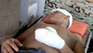 أحد ضحايا هجوم مليشيا الحوثي على سوق شعبي بالحديدة