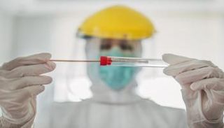 اختبار فيروس كورونا - أرشيفية