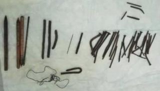 بعض القطع المعدنية التي تم استخراجها من معدة المريض الإثيوبي