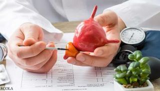 صورة تعبيرية لسرطان البروستاتا