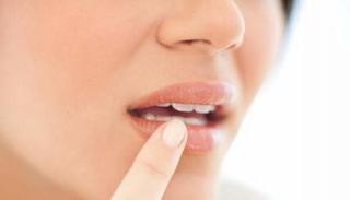 مشاكل الشفاه تعد أكثر من مجرد مشاكل جمالية