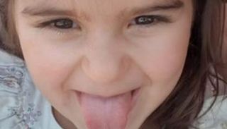 الطفلة ميلا