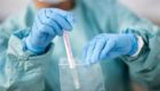 زيادة حادة في إصابات كورونا بروسيا خلال 24 ساعة