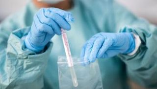 اختبار فيروس كورونا - أرشيفية