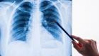 عدوى الفطر الأخضر.. إليك الأعراض