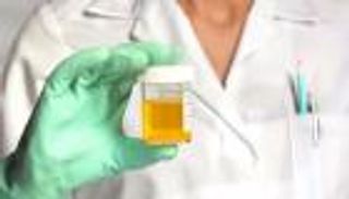 بدقة 100%.. اختبار بسيط يكشف عن أورام الدماغ مبكراً