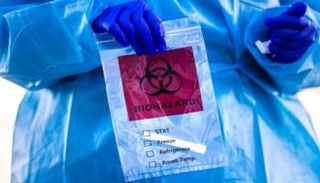 اختبار فيروس كورونا - أرشيفية