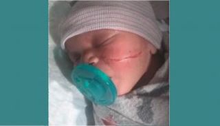 الطفلة بعد الولادة مباشرة