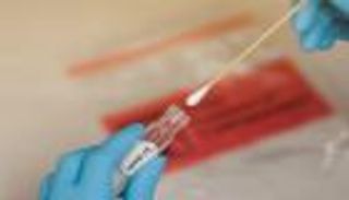 بعد تراجع الإصابات.. تخفيف "قيود كورونا" بتركيا أول يوليو