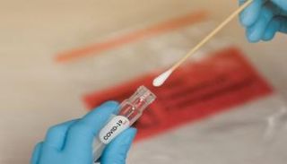 اختبار فيروس كورونا - أرشيفية