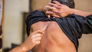 العلاج بسم النحل في مصر