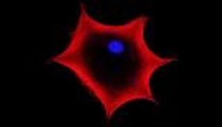 دراسة ثورية.. علماء يتوصلون إلى علاج للإيدز بـ"الخلايا الجذعية"