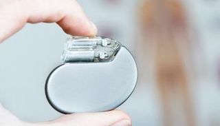 جهاز تنظيم ضربات القلب