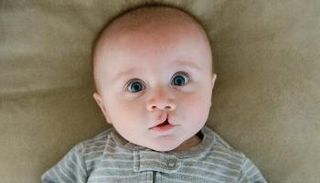 الشفة الأرنبية لدى الأطفال- أرشيفية