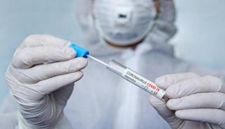 اختبار فيروس كورونا - أرشيفية