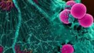 الخلايا السرطانية تأكل نفسها من أجل البقاء