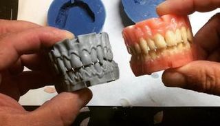 مريض يحصل على فك جديد بأسنان