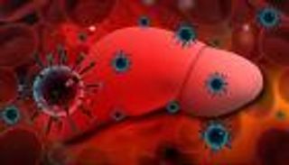 التهاب الكبد الوبائي "سي".. الأسباب والعلاج 