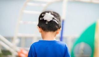 سقوط الطفل على رأسه يستلزم استشارة الطبيب