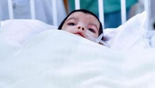 التوأم الطفيلي اليمني