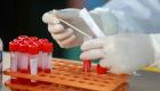 للمرة الأولى منذ عام.. كورونا يضرب ووهان الصينية مجددا