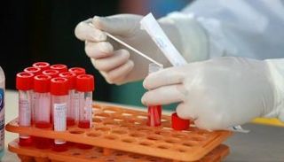 كورونا يعاود الظهور مجددا في ووهان الصينية - أ.ف.ب