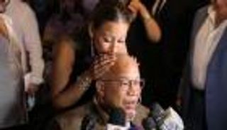 شريف الدسوقي يكشف لـ"العين الإخبارية" موعد تركيب الطرف الصناعي