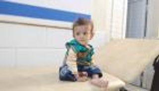 "سوء التغذية".. مرض صامت يفتك بأطفال المخيمات في المخا اليمنية