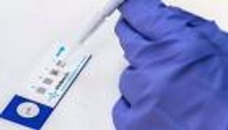 اختراق للكشف عن سرطان الدماغ مبكرا من عينة دم