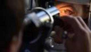 نصائح لمواجهة جفاف العين في سن اليأس