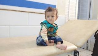طفل يميني يعاني من سوء التغذية