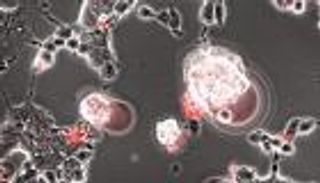 شاهد.. فيديو يرصد لحظة اختراق فيروس كورونا خلايا الدماغ