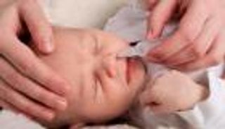 الخنفرة عند الرضع.. أسبابها وأعراضها وطرق العلاج