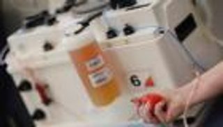 مصر تكشف عن الفئات الممنوعة من التبرع بالبلازما