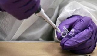 تحليل لحمض نووي- أسوشيتد برس