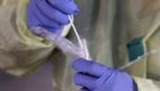 كورونا في اليمن.. ثاني أكبر حصيلة إصابات ووفيات خلال الموجة الثالثة