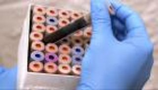 يرصد 50 نوعا من السرطان.. بريطانيا تبدأ أكبر اختبار دم في العالم