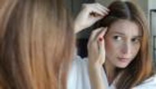 الشيب المبكر.. دراسة تكشف علاقة الطعام