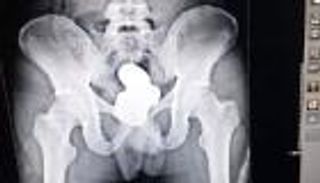 هندي يخفي كيلوجراما من عجينة الذهب بحيلة غريبة