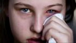 عدوى كورونا.. هل يمكن الإصابة بالفيروس عبر العين؟