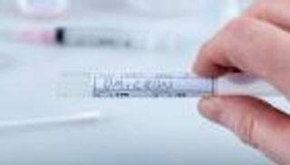 47 إصابة جديدة بمتحوّر "أوميكرون" في الجزائر