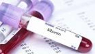 أطعمة ترفع الألبومين في الدم.. هذه أعراض زيادة وانخفاض نسبته