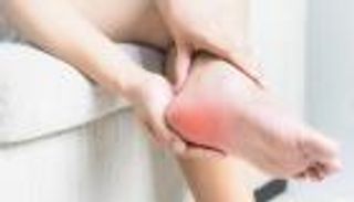 مسمار الكعب.. نصائح علاجية لتجنب الجراحة 