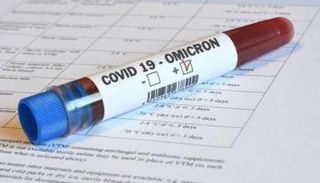 معدلات سريعة لانتشار أوميكرون