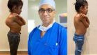 جراح حالات اعوجاج العمود الفقري الخطيرة: 4 علامات للاكتشاف المبكر