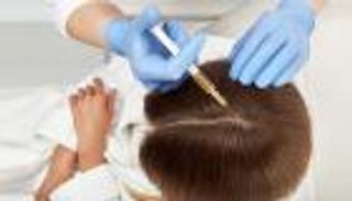 هل يوقف الحقن بالدم الذاتي تساقط الشعر؟