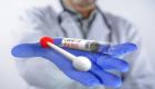 كيفية تشخيص أوميكرون.. طبيب يكشف الوسيلة الأكثر فاعلية