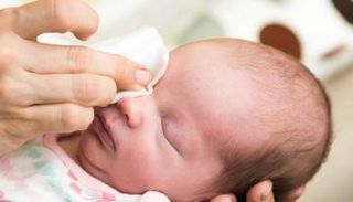 إفرازات العين عند الرضع- أرشيفية