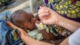 ما هو مرض الكواشيوركور؟.. الأعراض والأسباب وطرق العلاج